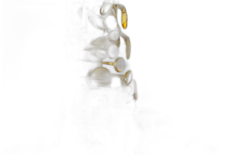 Corpo Latão Dourado Gold Lacquer
